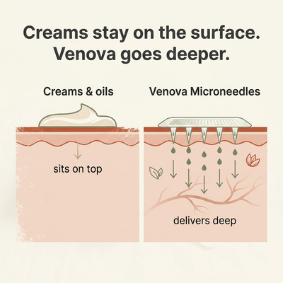 Venova® - VeinSmooth Microdart Patch